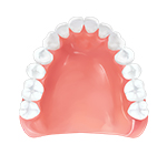 レジン床義歯(保険対応)